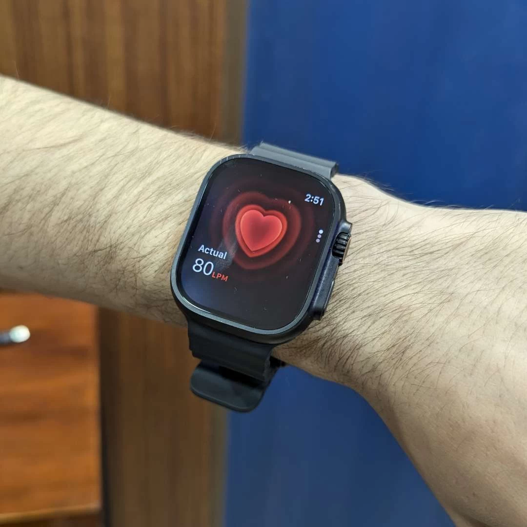 Apple Watch Ultra 3 - imagen 5